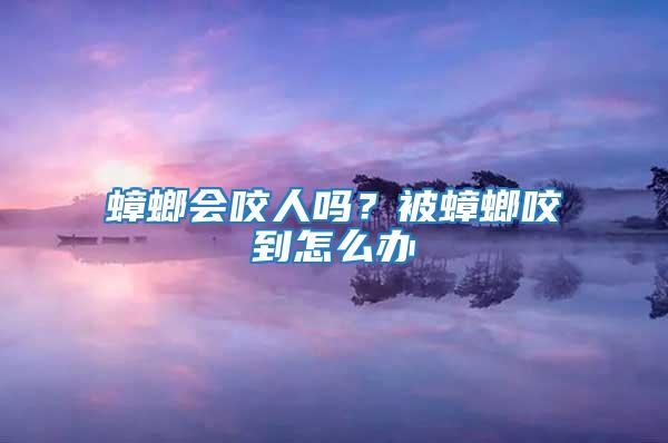 蟑螂會咬人嗎？被蟑螂咬到怎么辦